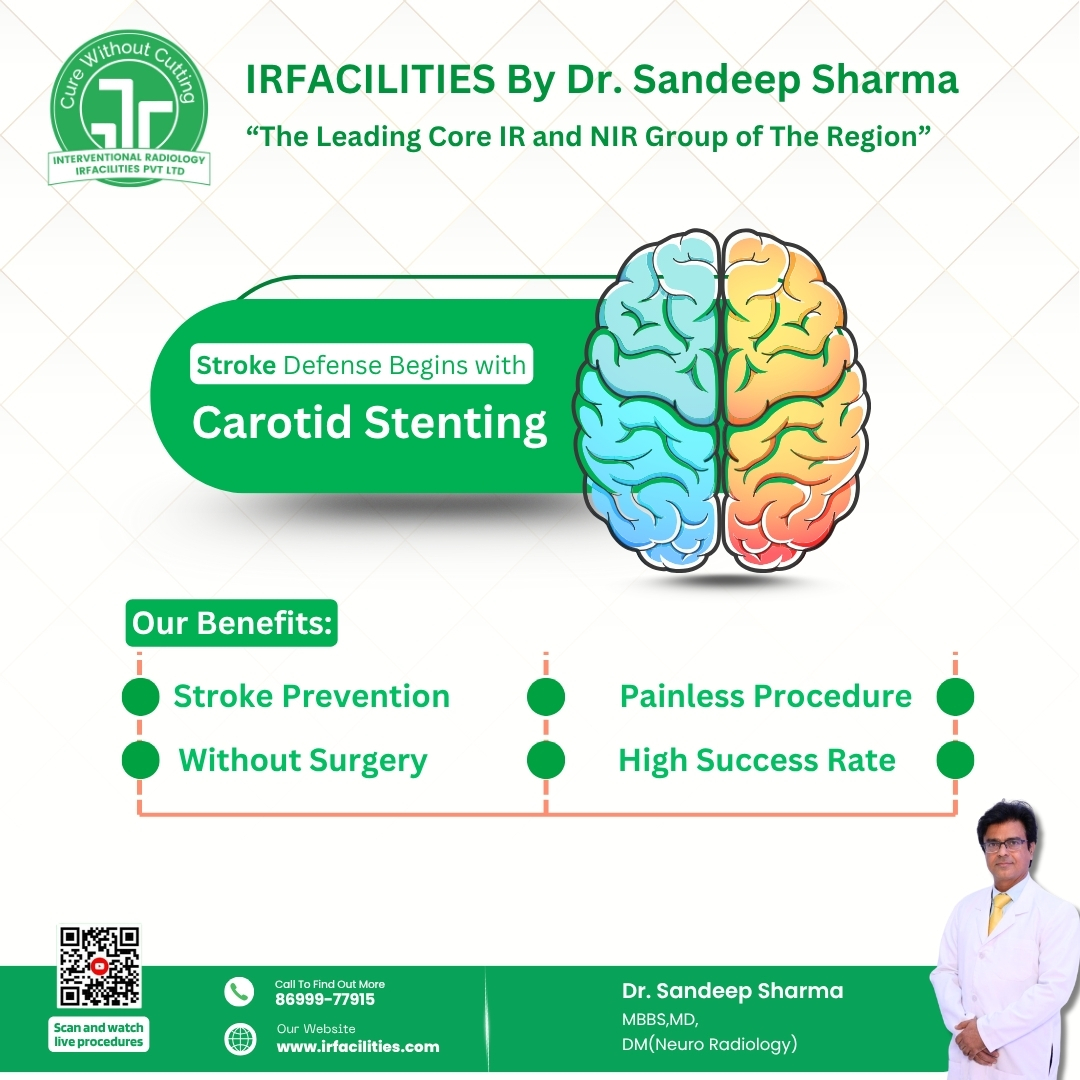 Minimally Invasive Carotid Artery Stenting Procedure